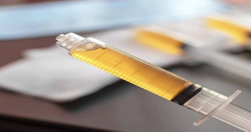 PRP-Il-plasma-ricco-di-piastrine